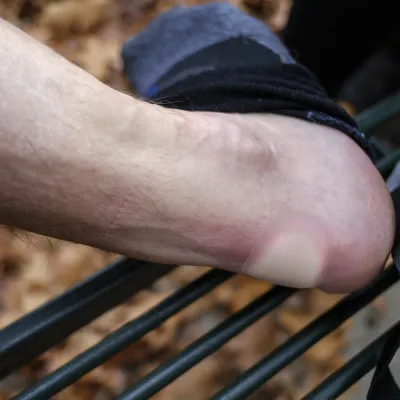 Lifesystems набор пластырей Blister Plasters - 3 Lifesystems набор пластырей Blister Plasters - 3 - Robinzon.ua